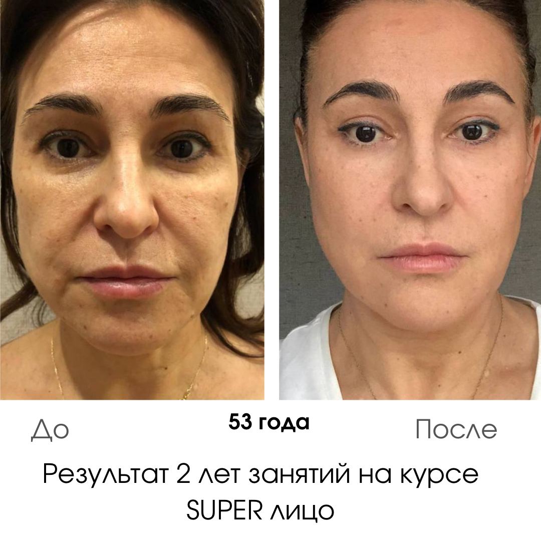 Анастасия бурдюг разоблачение до и после пластики фото